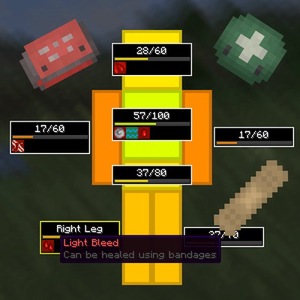 Мод Medical System для Minecraft 1.21.11 neoforge, 1.21.10 neoforge, 1.21.9 neoforge,  ...