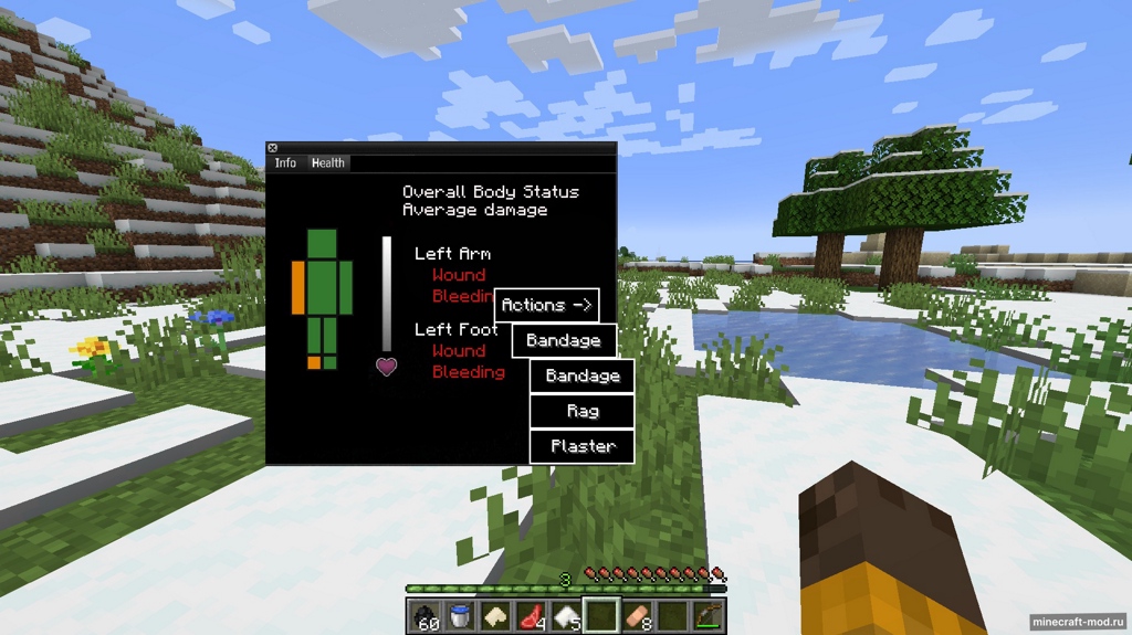 Мод Zomboid Health System для Minecraft 1.20.1